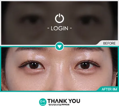 Before & After