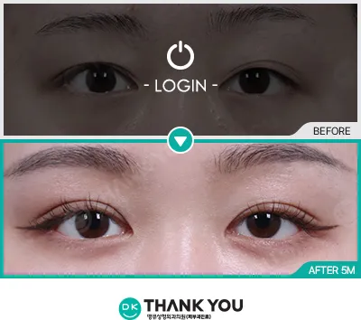Before & After