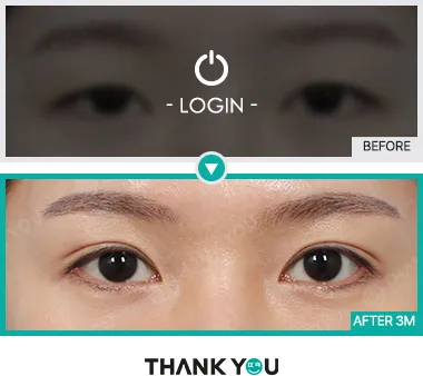 Before & After