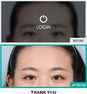 Before & After