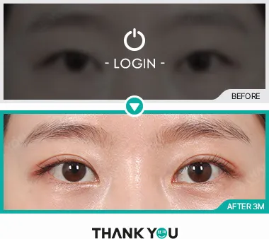 Before & After