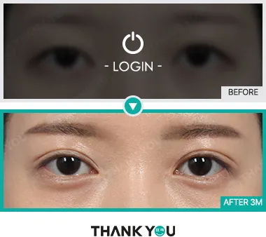 Before & After