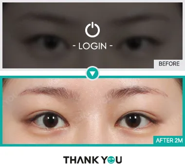 Before & After