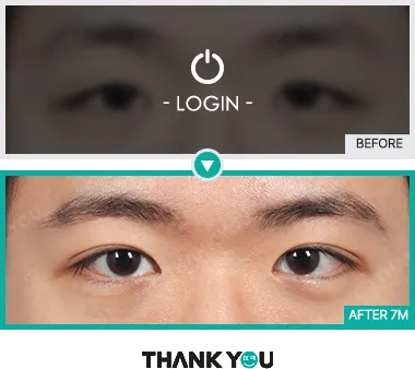 Before & After