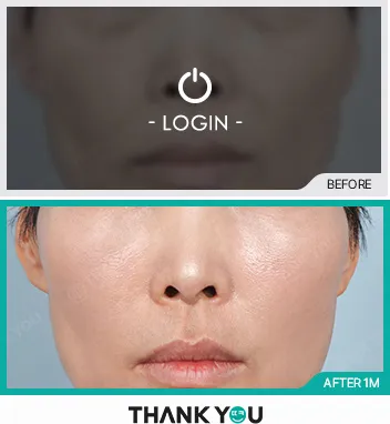Before & After