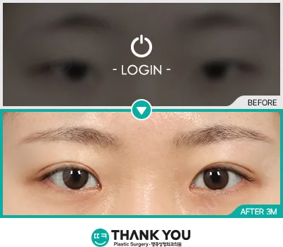 Before & After