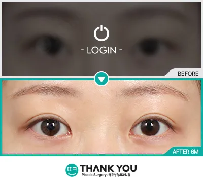 Before & After
