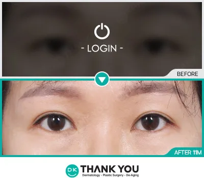 Before & After