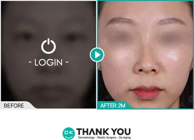 Before & After