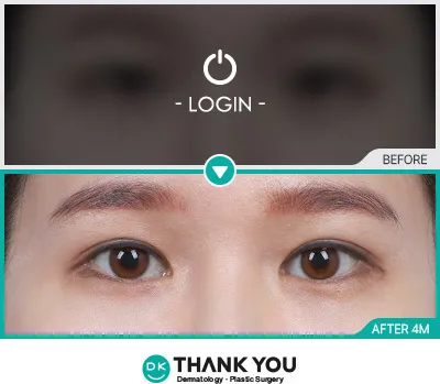 Before & After