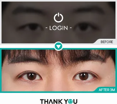 Before & After