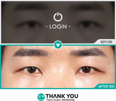 Before & After
