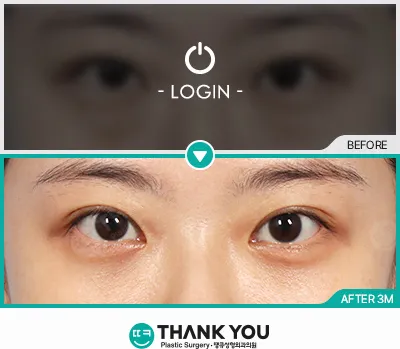 Before & After