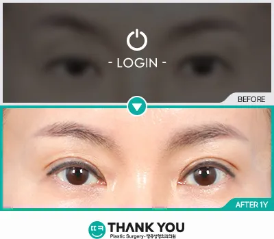Before & After