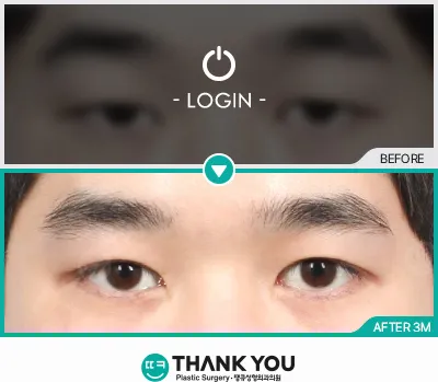Before & After