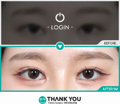 Before & After