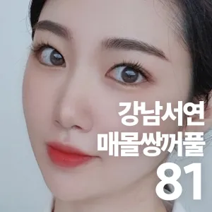 江南Seoyeon 埋線雙眼皮