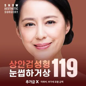 中年眼部整形 上眼瞼 提眉術 (眉下切開)