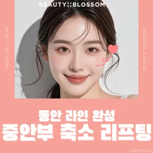 完成童顏線條_中臉縮短拉提