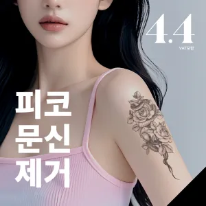 Girin 刺青去除, Pico Andy, 彩色刺青去除, 眉毛紋繡去除