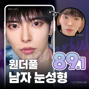 Wonderful_男士眼部整形