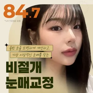 Wonderful_非切開眼型矯正