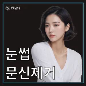 一山 眉毛紋身去除