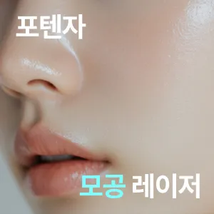 Potenza 高頻雷射 1次 - 皮膚管理, 縮小毛孔, 痘疤 & 泛紅改善, 強化皮膚彈力, 去除細紋