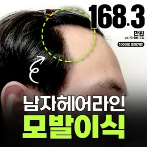 偶像 (Idol) 髮際線植髮