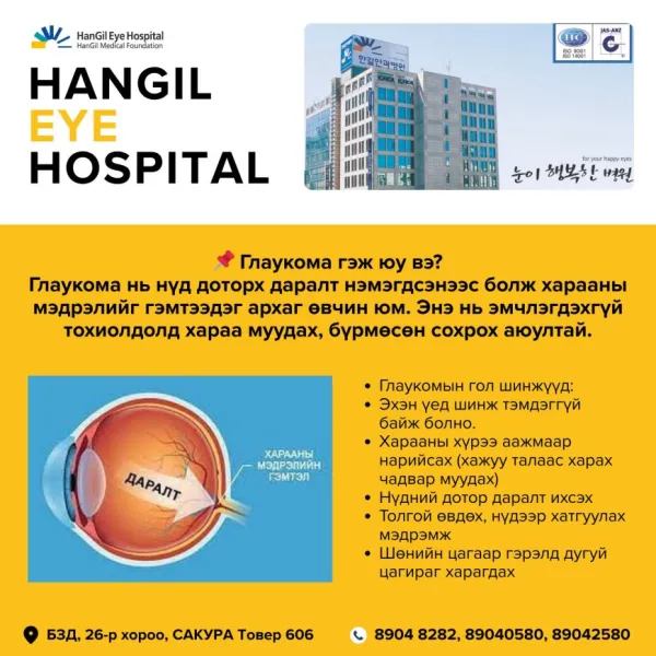 Глаукома гэж юу вэ?