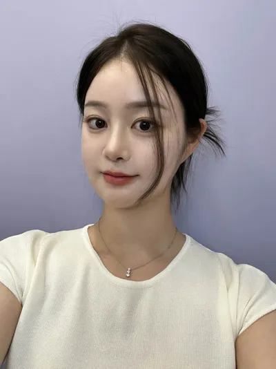 做了臉部輪廓+鼻重修♥