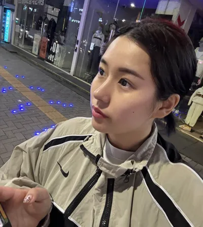 做了無假體自體肋軟骨隆鼻手術！！