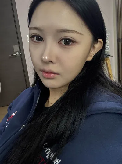 做了鼻重修，拍自拍變得很開心 :)