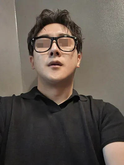 男性 / 同時進行了隆鼻、臉部輪廓、雙下巴肌肉縫合。