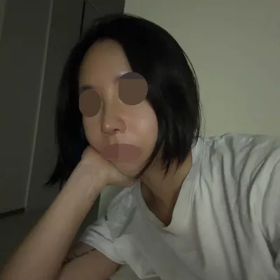 Want 金賢宇院長鼻部修復手術（自體肋軟骨）心得