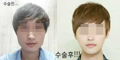 你好。隔了好久才去醫院複診，