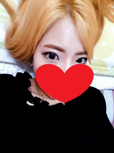 Apex Harmony眼部整形真嘅超讚啊!!!!!!!!!!!!!!!!!