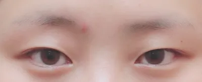 眼型矯正滿一個月了^^