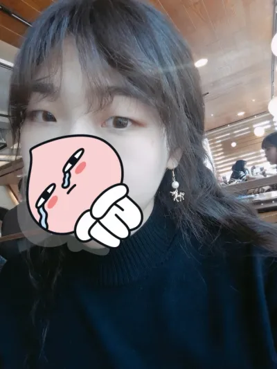 切開眼型矯正+開眼頭手術 讚!!!