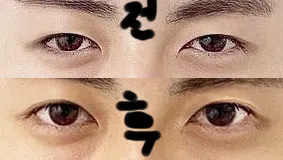 原來也有很多男生來做手術啊。