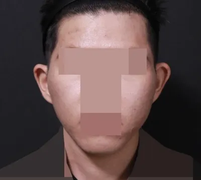 看得出臉型在改變。