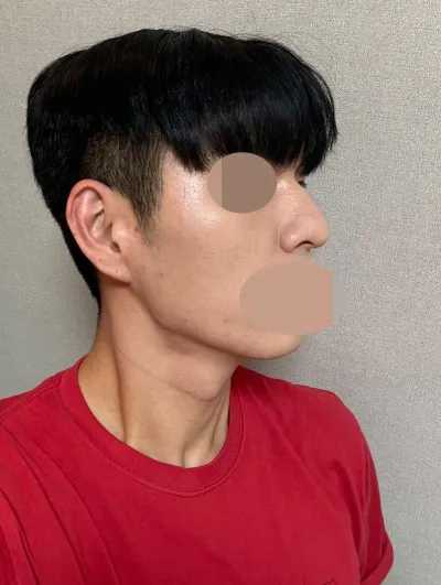 因為很自然，大家都在問。