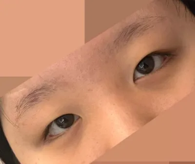 因為一直用雙眼皮貼，想過得輕鬆點所以選擇了這個！