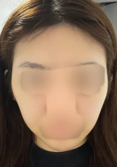 我很滿意現在的臉型哈哈