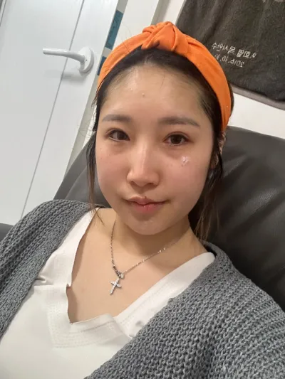 既然下定決心，就連眼睛和鼻子一起做了，非常非常滿意。