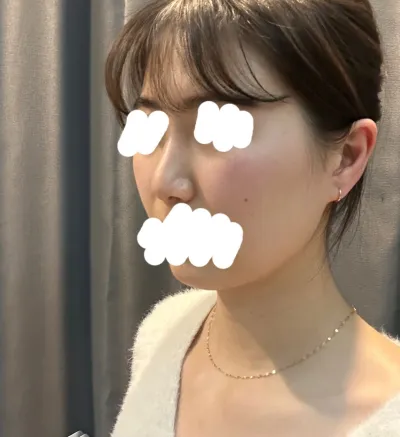 我非常滿意，Very Good 整形外科最棒了，最棒了。