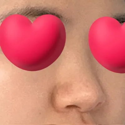 特別是正面改善得很好，非常滿意。