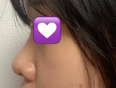 因為大家都說我變漂亮了，最近每天都過得很幸福。