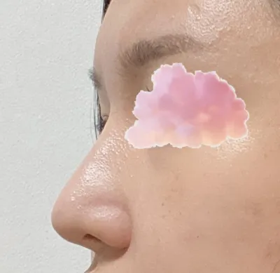 這是我整形至今，第一家這麼用心照顧我的醫院。