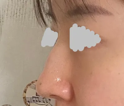 解說非常親切詳盡，手術也非常成功，我很滿意！